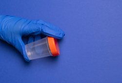 Microbioma seminale, cos’è e perché influenza la fertilità maschile. Lo studio