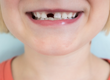 L’inflazione colpisce anche la fatina dei denti