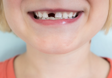 L’inflazione colpisce anche la fatina dei denti