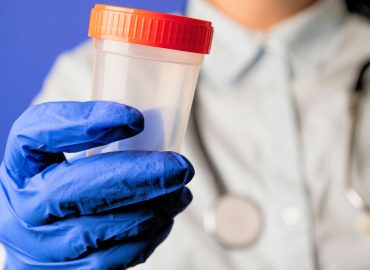 Fertilità, temperature alte e sperma basso: il rischio aumenta del 46% a 30 gradi