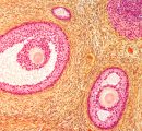 Il primo atlante dell’ovaio umano apre nuove vie alla fertilità