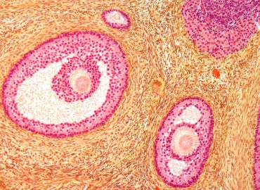 Il primo atlante dell’ovaio umano apre nuove vie alla fertilità