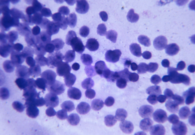 Scoperti i misteri dei cromosomi sessuali
