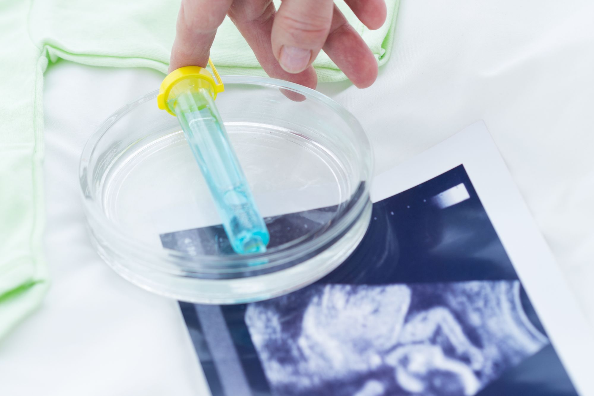 Procreazione assistita, ok impianto embrione anche in caso di decesso o separazione