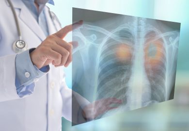 Come un oncologo riduce il rischio di cancro: 5 abitudini chiave