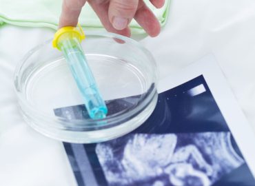 Spermatozoi danneggiati raddoppiano il rischio di ipertensione in gravidanza