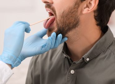 Un tampone orale per predire la morte? La scoperta del Test CheekAge