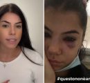 Chiara Balistreri su TikTok: “Il mio ex scappato dai domiciliari, registro prima che diventi l’ennesimo caso di femminicidio”
