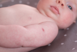 Neonati, adolescenti, future mamme: la catena della protezione vaccinale