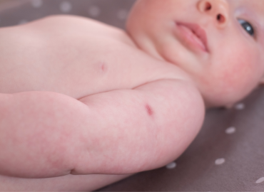 Proteggere i neonati dal virus respiratorio sinciziale: cosa c’è da sapere su vaccino in gravidanza e anticorpi