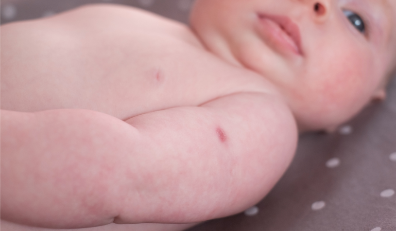 Proteggere i neonati dal virus respiratorio sinciziale: cosa c’è da sapere su vaccino in gravidanza e anticorpi