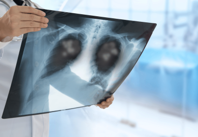 Polmoniti in crescita: la morte di Val Kilmer segna “l’anno della ribalta globale”