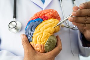 Cervello Canva