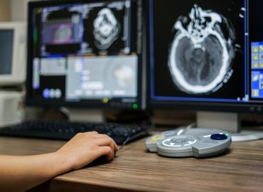 Un impianto neuronale è in grado di “leggere i pensieri”: come funziona