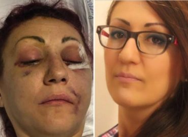 Sfigurata dall’ex marito, l’uomo non andrà in carcere: “Lei ha sfaldato il matrimonio”