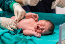 Come si dona il sangue del cordone ombelicale e perché solo poche donne lo fanno