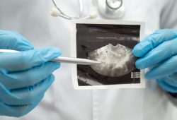 Trasposizione uterina, primo caso in Italia: cos’è e perché è importante per la fertilità?