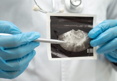 Trasposizione uterina, primo caso in Italia: cos’è e perché è importante per la fertilità?