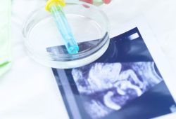 Social freezing gratuito per le dipendenti Otb: benefit o “maternità posticipata”?