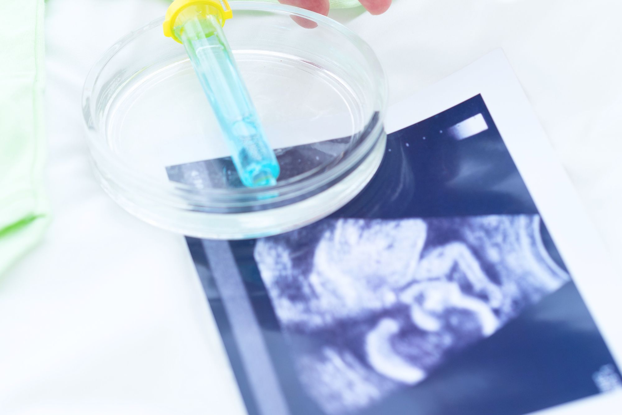 Social freezing gratuito per le dipendenti Otb: benefit o “maternità posticipata”?