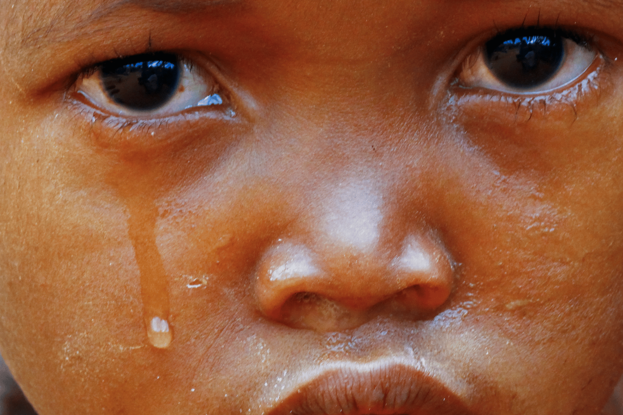 Nel 2026 4,5 milioni di bambine rischiano le mutilazioni genitali (16mila sono in Italia)