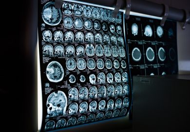 Leggere il pensiero con il suono, una startup sfida Neuralink di Musk con gli ultrasuoni