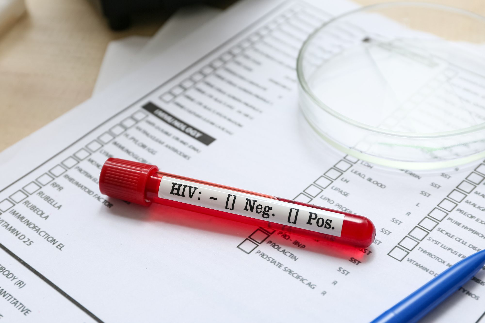 Hiv, 331 bambini contagiati con siringhe infette in un ospedale pubblico