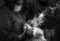 Vaginal seeding: si può imitare il microbioma del parto naturale?