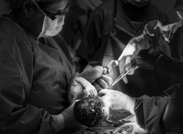 Vaginal seeding: si può imitare il microbioma del parto naturale?