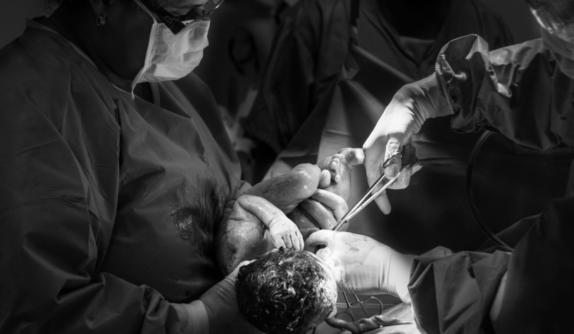 Vaginal seeding: si può imitare il microbioma del parto naturale?