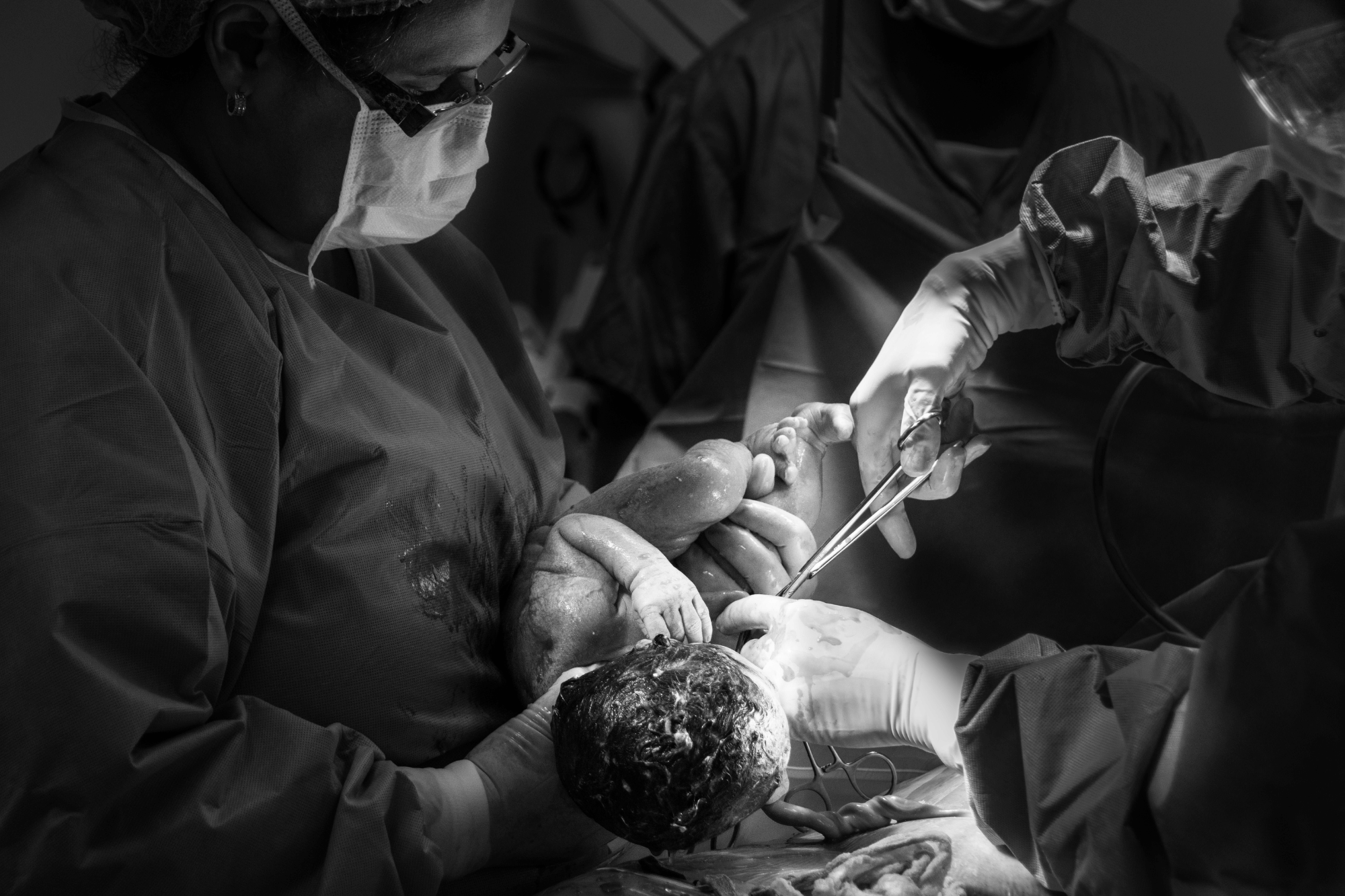 Vaginal seeding: si può imitare il microbioma del parto naturale?