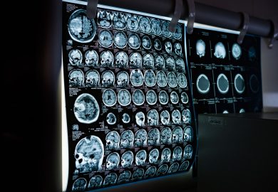 Cervello maschile e femminile: la differenza (sottile) è scritta nei geni