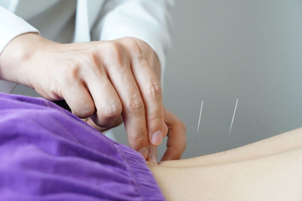 Agopuntura per fertilità - Canva