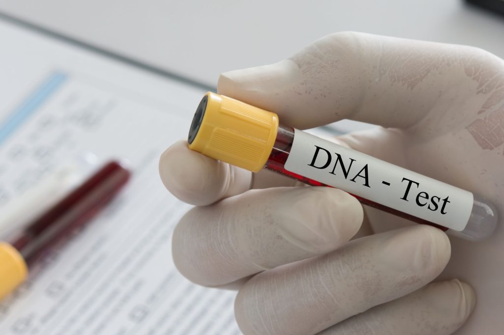 Dna test- Canva