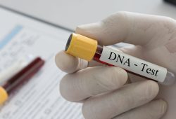 Troppi “fratelli”? L’Europa dice basta ai super-donatori