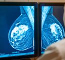 A 72 minuti da una mammografia: nell’entroterra siciliano solo 4 donne su 10 arrivano allo screening