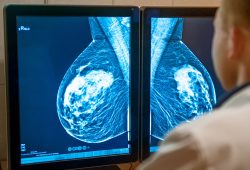 A 72 minuti da una mammografia: nell’entroterra siciliano solo 4 donne su 10 arrivano allo screening