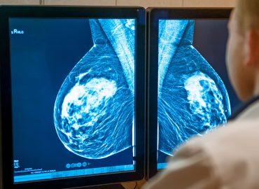 A 72 minuti da una mammografia: nell’entroterra siciliano solo 4 donne su 10 arrivano allo screening