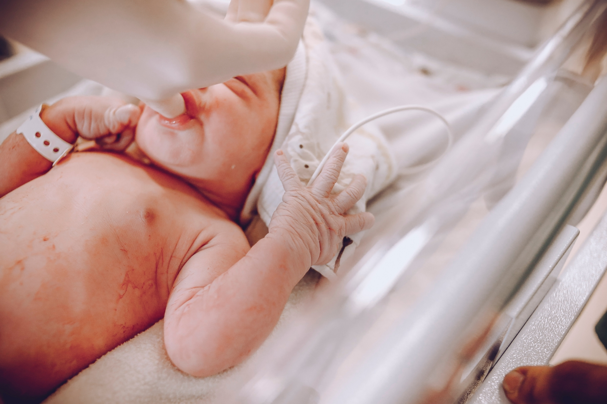 Musicoterapia per i bambini prematuri: al Miulli la voce dei genitori entra nelle incubatrici