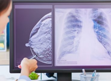 L’intelligenza artificiale scopre le malattie cardiache dalla mammografia