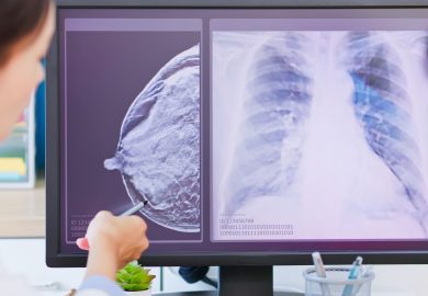 L’intelligenza artificiale scopre le malattie cardiache dalla mammografia